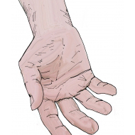 Hand without aggregate - colour (Artist: Shaw, Rod)