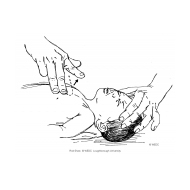 Chest compressions to an infant (Artist: Shaw, Rod)